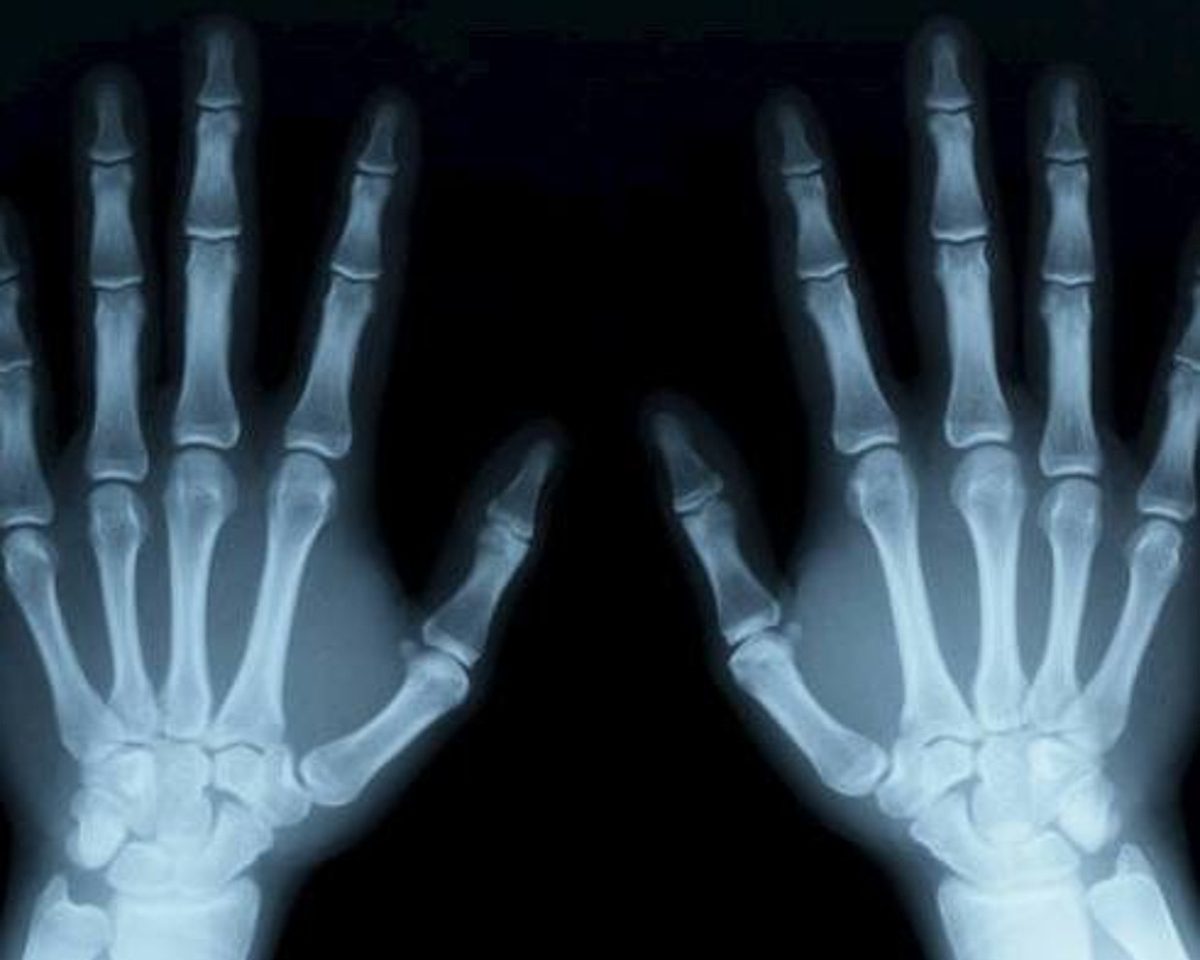 csm_xray_l_22fbb969f8